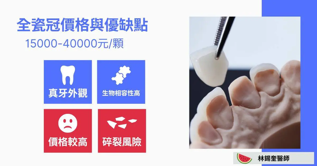 三種牙冠價格比比看,牙冠價格ptt鄉民說「這材質」可用很久 3 全瓷牙冠套價格與優缺點