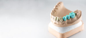 artificial jaw with green teeth EDAAHM7