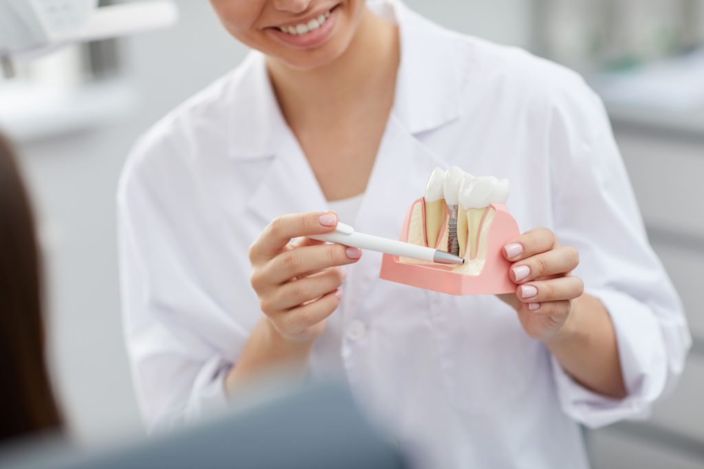 dentist explaining tooth implantation process 2021 09 24 03 53 47 utc 2 1