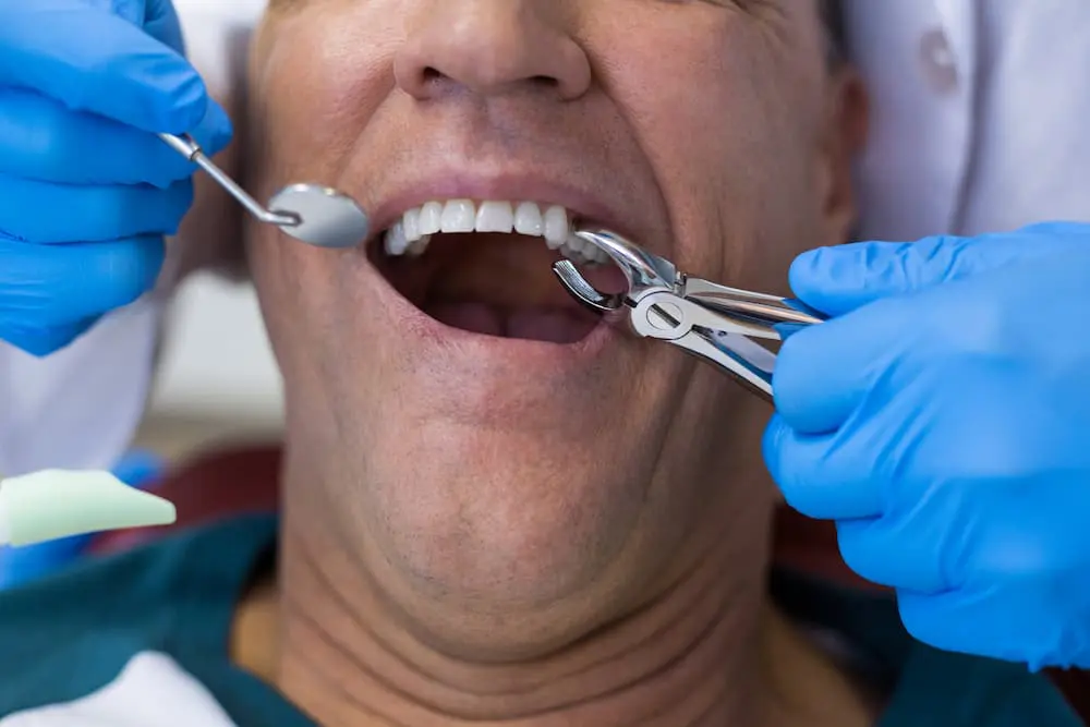 最新消息 5 dentist using surgical pliers to remove a decaying P3ZN4F9 1