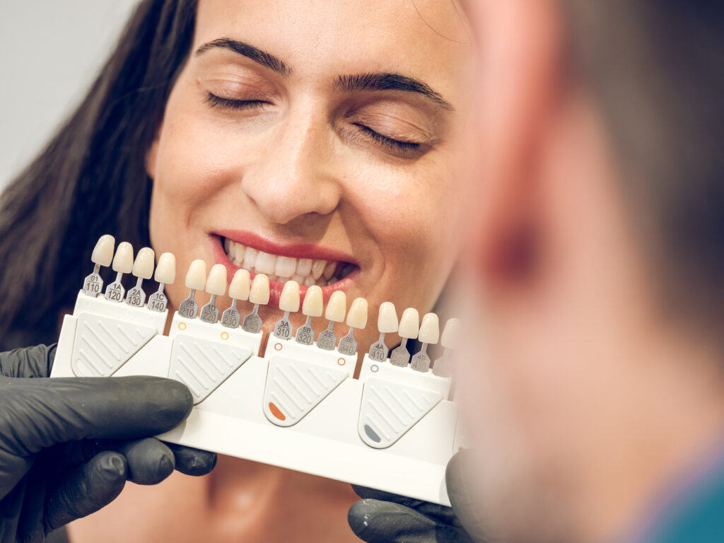 dentist picking shade of implants for veneers for 2023 11 27 05 06 28 utc