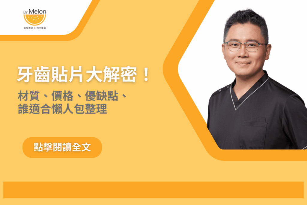 牙齒貼片大解密！材質、價格、優缺點、誰適合懶人包整理