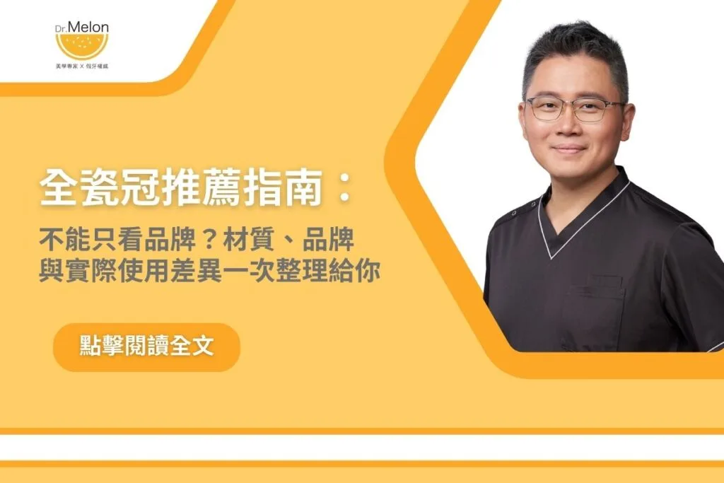 全瓷冠推薦指南：不能只看品牌？材質、品牌與實際使用差異一次整理給你