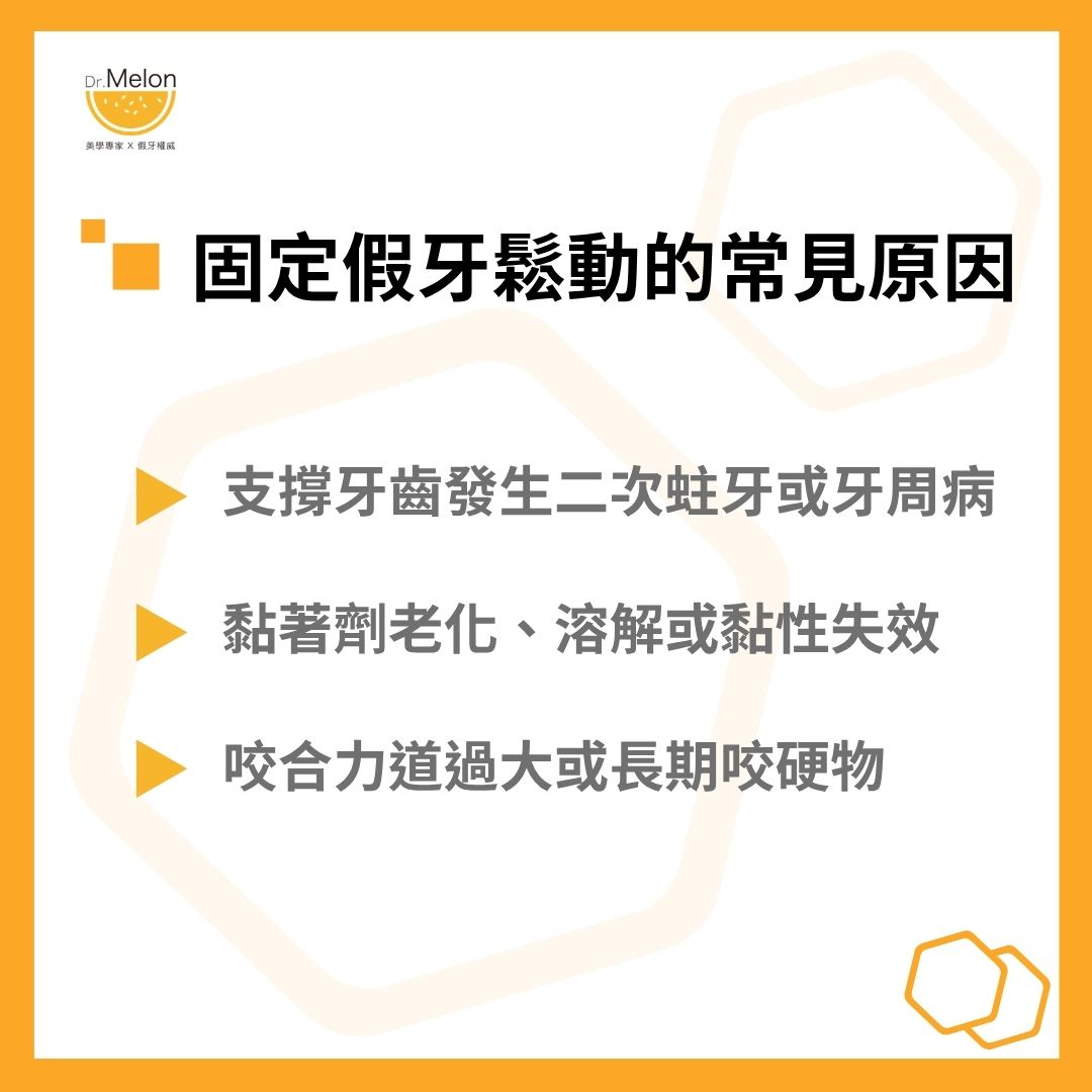 固定假牙鬆動的常見原因