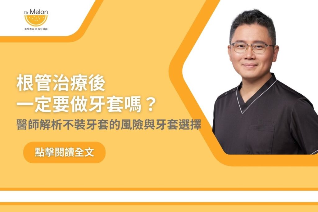 根管治療後一定要做牙套嗎？醫師解析不裝牙套的風險與牙套選擇