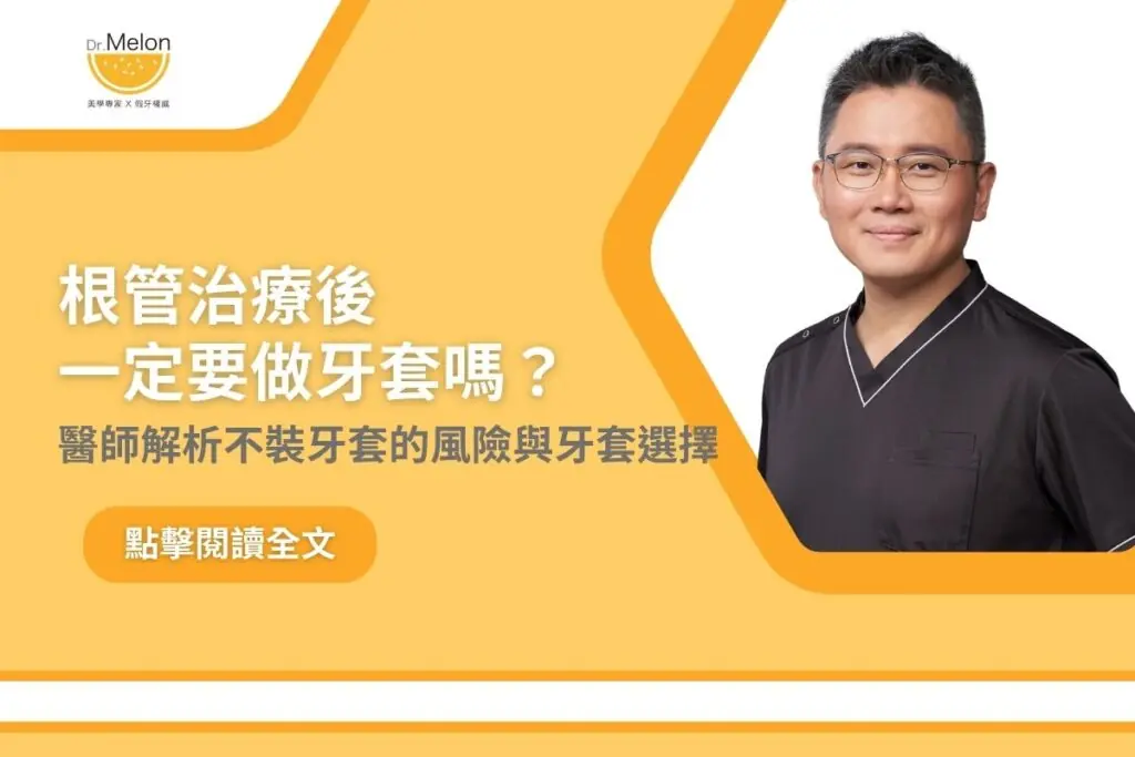 根管治療後一定要做牙套嗎？醫師解析不裝牙套的風險與牙套選擇