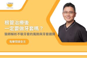 全瓷冠 1 根管治療後一定要做牙套嗎?醫師解析不裝牙套的風險與牙套選擇